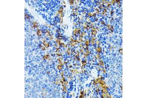Immunohistochemistry of paraffin-embedded mouse spleen using J Rabbit mAb (ABIN7268036) at dilution of 1:100 (40x lens). (JAK1 anticorps)