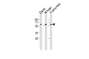 Western blot analysis of lysates from Daudi cell line, human heart and ncreas tissue lysate(from left to right), using CSIN1 Antibody (G23) (ABIN392664 and ABIN2842162). (PACSIN1 anticorps  (N-Term))