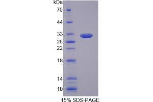Image no. 1 for Microfibrillar-Associated Protein 4 (MFAP4) (AA 22-255) protein (His tag) (ABIN6237112) (MFAP4 Protein (AA 22-255) (His tag))