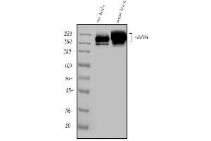 Western blot analysis of Nefh using anti-Nefh antibody (ABIN7599700). (NEFH anticorps  (AA 109-466))