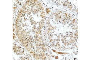 anti-Cryptochrome 1 (Photolyase-Like) (CRY1) (AA 153-189), (N-Term) antibody
