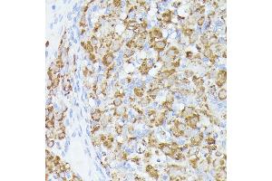 Immunohistochemistry of paraffin-embedded rat ovary using  antibody (ABIN6131166, ABIN6136417, ABIN6136418 and ABIN6223845) at dilution of 1:100 (40x lens). (ACAT2 anticorps  (AA 1-97))