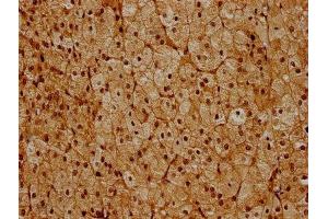IHC image of ABIN7142226 diluted at 1:600 and staining in paraffin-embedded human adrenal gland tissue performed on a Leica BondTM system. (PSMC6 anticorps  (Regulatory Subunit 10B))