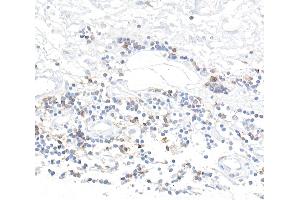 Immunohistochemistry (IHC) image for anti-CD96 (CD96) (AA 29-502) antibody (ABIN7455093) (Recombinant CD96 anticorps  (AA 29-502))
