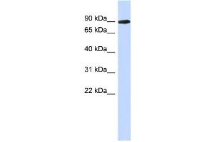 WB Suggested Anti-PGM2L1 Antibody Titration: 0.