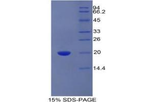 SDS-PAGE analysis of Human PROCR Protein.