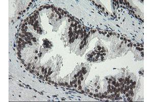 Image no. 2 for anti-Transducin-Like Enhancer of Split 1 (E(sp1) Homolog, Drosophila) (TLE1) (AA 180-460) antibody (ABIN1491049)