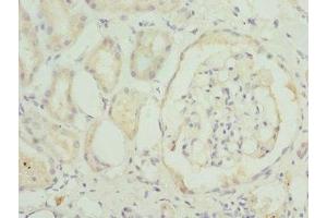 Immunohistochemistry of paraffin-embedded human kidney tissue using ABIN7172352 at dilution of 1:100 (TRAPPC1 anticorps  (AA 1-260))