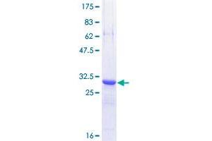 Trefoil Factor 3 (Intestinal) (TFF3) (AA 15-73) protein (GST tag)