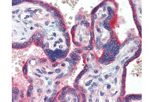 Anti-ZNF165 antibody IHC of human placenta. (ZNF165 anticorps  (AA 216-265))