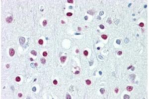 Anti-WHSC1 / NSD2 antibody IHC staining of human brain, cortex. (WHSC1 anticorps  (AA 219-268))