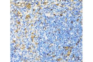 Immunohistochemistry of paraffin-embedded Mouse spleen using CD27 Polyclonal Antibody at dilution of 1:100 (40x lens). (CD27 anticorps)