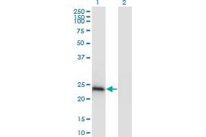 Western Blot analysis of CBX1 expression in transfected 293T cell line by CBX1 monoclonal antibody (M01), clone 4E12.