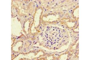 Immunohistochemistry of paraffin-embedded human kidney tissue using ABIN7169234 at dilution of 1:100 (WNK4 anticorps  (AA 828-1106))