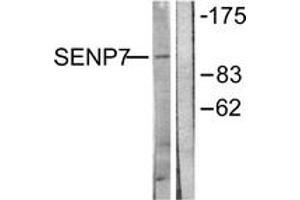 Western blot analysis of extracts from HuvEc cells, using SENP7 Antibody. (SENP7 anticorps  (AA 991-1040))