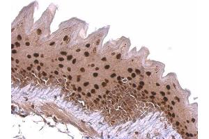 IHC-P Image KLF4 antibody detects KLF4 protein at nucleus on mouse esophagus by immunohistochemical analysis.
