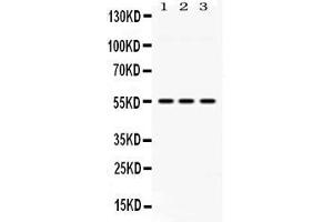 Western blot analysis of MPP1 expression in rat lung extract ( Lane 1), mouse spleen extract ( Lane 2) and MCF-7 whole cell lysates ( Lane 3).