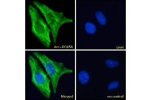 ABIN6391376 Immunofluorescence analysis of paraformaldehyde fixed HeLa cells, permeabilized with 0. (DDX58 anticorps  (C-Term))
