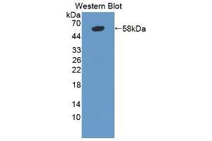 Western blot analysis of the recombinant protein. (TNXB anticorps  (AA 3835-4088))