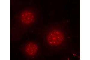 Immunofluorescence (IF) image for anti-Forkhead Box O4 (FOXO4) (pSer197) antibody (ABIN1870198)