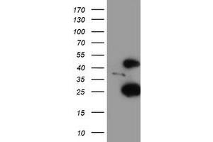 Western Blotting (WB) image for anti-Centromere Protein H (CENPH) antibody (ABIN1497470) (CENPH anticorps)