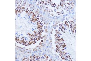 Immunohistochemistry of paraffin-embedded mouse testis using P antibody (ABIN7269446) at dilution of 1:100 (40x lens).