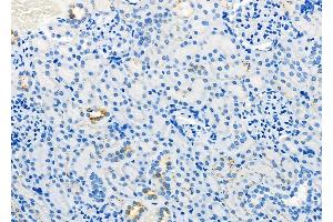 ABIN6260006 and ABIN6279136 at 1/100 staining Rat kidney tissue by IHC-P. (AQP11 anticorps  (Internal Region))
