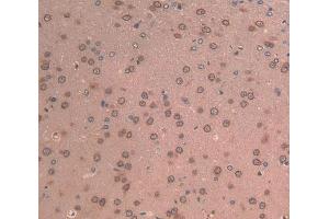 IHC-P analysis of brain tissue, with DAB staining. (LAMB2 anticorps  (AA 75-223))
