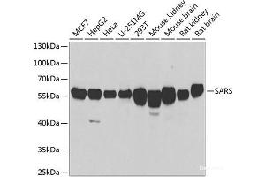 Western blot analysis of extracts of various cell lines using SARS Polyclonal Antibody at dilution of 1:1000. (Seryl-tRNA Synthetase (SARS) anticorps)