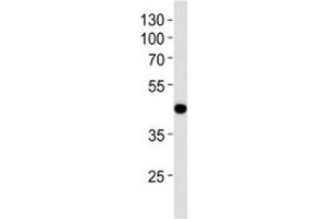 Western blot analysis of lysate from NCI-H292 cell line using AIM2 antibody at 1:1000.