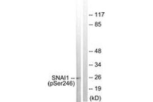 Western blot analysis of extracts from HT29 cells, using SNAI1 (Phospho-Ser246) Antibody. (SNAIL anticorps  (pSer246))