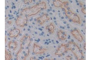 DAB staining on IHC-P; Samples: Rat Kidney Tissue