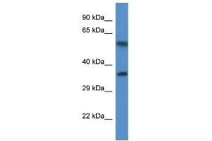 Western Blot showing MRPL45 antibody used at a concentration of 1.