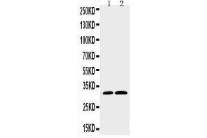 Anti-Caspase-3(P10),  Western blotting Lane 1: HELA Cell Lysate Lane 2: SMMC Cell Lysate (Caspase 3 anticorps  (C-Term))
