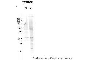 Western Blotting (WB) image for anti-14-3-3 epsilon (YWHAE) (Middle Region) antibody (ABIN504582) (YWHAE anticorps  (Middle Region))