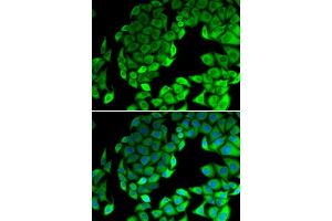 Immunofluorescence analysis of MCF-7 cells using RPL14 antibody (ABIN6291381). (RPL14 anticorps)