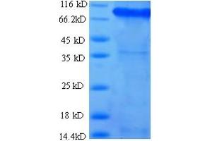 SDS-PAGE (SDS) image for Succinate Dehydrogenase Complex, Subunit A, Flavoprotein (Fp) (SDHA) (AA 44-664) protein (His-SUMO Tag) (ABIN5710326)