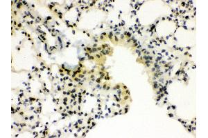 Immunohistochemistry (Paraffin-embedded Sections) (IHC (p)) image for anti-Sp3 Transcription Factor (Sp3) (AA 569-599), (C-Term) antibody (ABIN3043350)