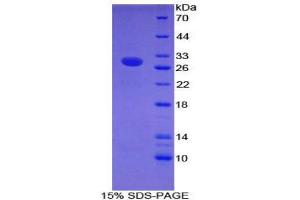 SDS-PAGE (SDS) image for Intercellular Adhesion Molecule 2 (ICAM2) (AA 27-248) protein (His tag) (ABIN1879544)