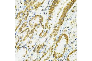 Immunohistochemistry of paraffin-embedded human esophagus using HLA-DQA1 antibody (ABIN5971195) at dilution of 1/100 (40x lens). (HLA-DQA1 anticorps)
