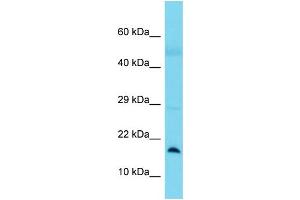 Host:  Rabbit  Target Name:  BLOC1S1  Sample Type:  Lung Tumor lysates  Antibody Dilution:  1. (BLOC1S1 anticorps  (N-Term))
