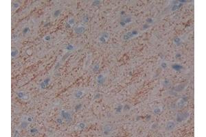 Detection of DBP in Human Cerebrum Tissue using Polyclonal Antibody to Vitamin D Binding Protein (DBP)