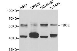 Western blot analysis of extracts of various cell lines, using TBCE antibody. (TBCE anticorps)