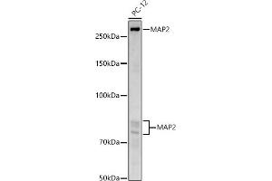 Western blot analysis of extracts of PC-12 cells, using M antibody (ABIN3016264, ABIN3016265, ABIN3016266, ABIN1680752 and ABIN6219676) at 1:1000 dilution.