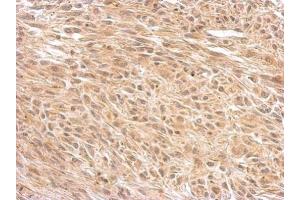 IHC-P Image O-GlcNAc transferase antibody [N1N2], N-term detects OGT protein at cytosol on U373 xenograft by immunohistochemical analysis.