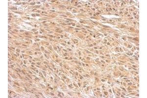 IHC-P Image O-GlcNAc transferase antibody [N1N2], N-term detects OGT protein at cytosol on U373 xenograft by immunohistochemical analysis. (OGT anticorps  (N-Term))