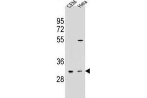 Western Blotting (WB) image for anti-Olfactory Receptor, Family 5, Subfamily L, Member 2 (OR5L2) antibody (ABIN2995999) (OR5L2 anticorps)