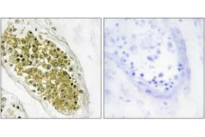 Immunohistochemistry analysis of paraffin-embedded human testis tissue, using HIPK4 Antibody.