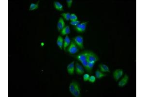 Immunofluorescence staining of Hela cells with ABIN7170075 at 1:100, counter-stained with DAPI.
