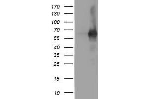 Western Blotting (WB) image for anti-phosphodiesterase 1B, Calmodulin-Dependent (PDE1B) antibody (ABIN1500073) (PDE1B anticorps)